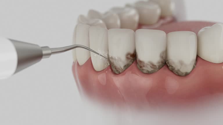Reliable Dental Implants contractor in Norwich, CT by Smile Center Dentistry